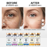  6-IN-1 Face Serum Trio-Vitamin C,Face Retinol & Hyaluronic Acid Anti-Aging Serums,Skincare Routine -Brightening,Facial Serums