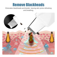 Deep Vibrate Skin Scrubber Facial Cleaner Shovel Spatula Not Ultrasonic Face Scrubberpeeling Blackhead Remover Facial Ma Ssager